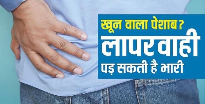 यूरिन में ब्लीडिंग को न करें इग्नोर: क्या पेशाब में खून आना किडनी कैंसर का पहला अलर्ट है? जानिए सच