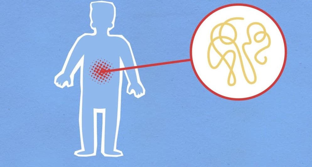 Monsoon Stomach Infection: बारिश में रहना है सेहतमंद, तो आज ही बदल लें ये 4 आदतें; डॉक्टरों ने बताए पेट के संक्रमण से बचने के आसान उपाय