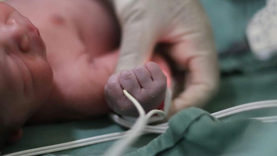 Birth Weight And Adult Health: क्या जन्म के समय आपका वजन भी था कम? जानें रिसर्च का ये चौंकाने वाला 'स्ट्रोक' कनेक्शन