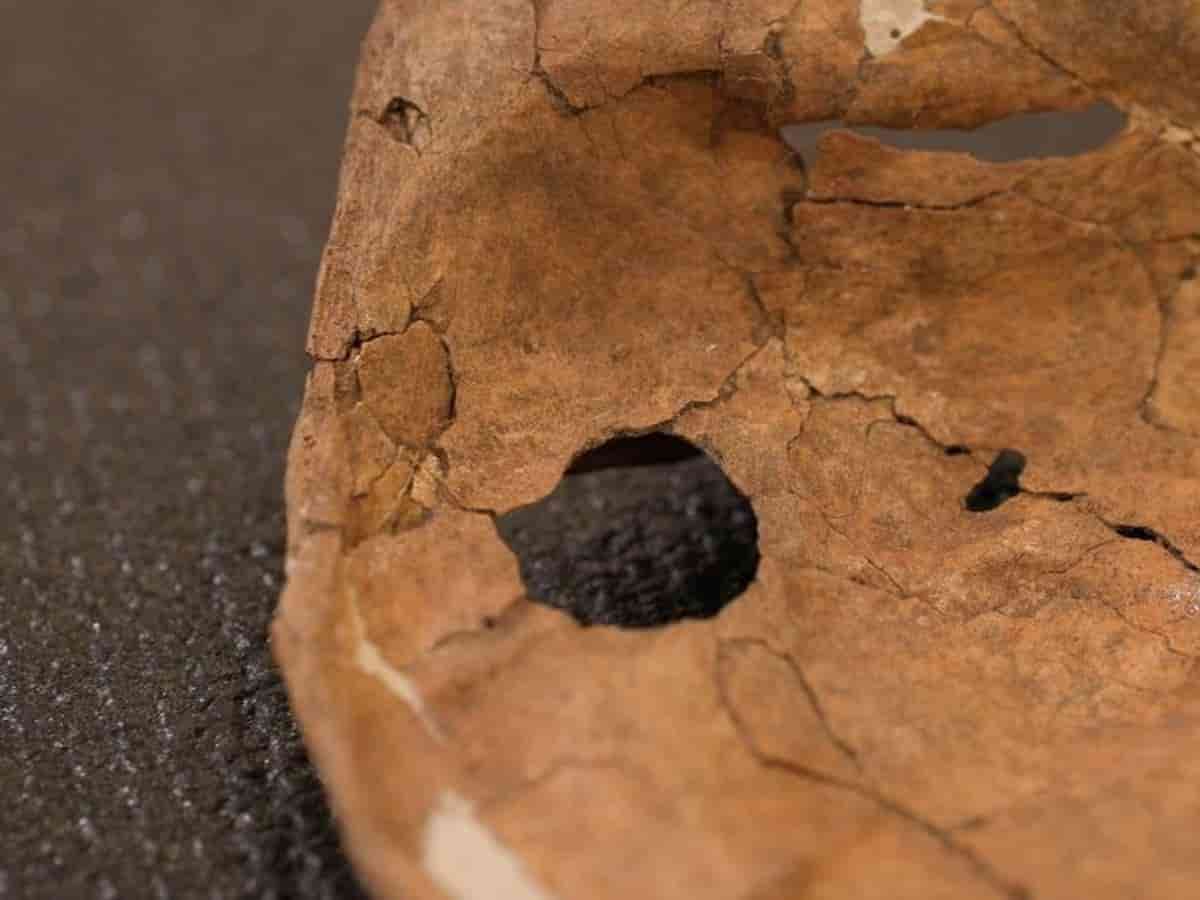 75 हजार साल पहले हुआ था मर्डर, कंकाल से खुला दुनिया के सबसे पुराने कत्ल का खौफनाक राज